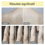 Eponge Exfoliante Ultra Douce