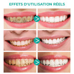 Mousse de nettoyage des dents